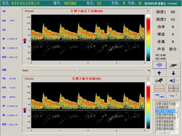 經(jīng)顱多普勒雙通道，單深度界面