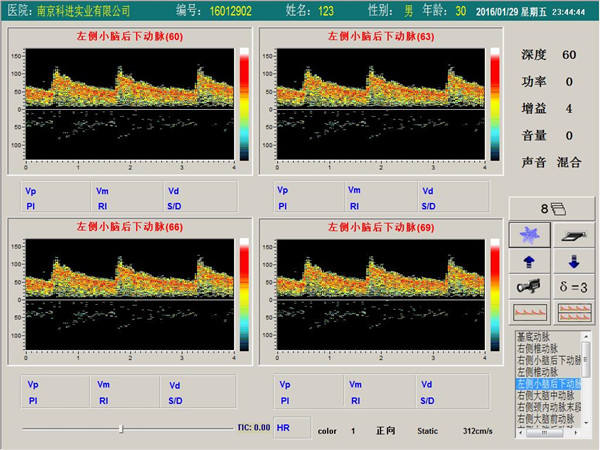 經(jīng)顱多普勒單通道，四深度界面