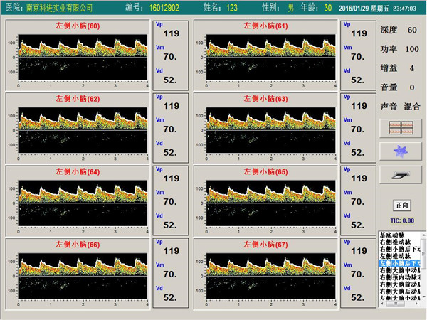 經(jīng)顱多普勒單通道，八深度界面