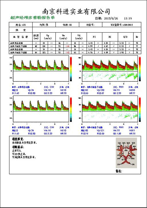 經(jīng)顱多普勒?qǐng)?bào)告圖.jpg