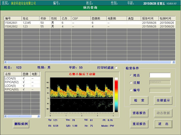 經(jīng)顱多普勒報告查詢界面.jpg