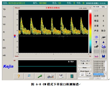 經(jīng)顱多普勒軟件cw模式下檢測界面.JPG