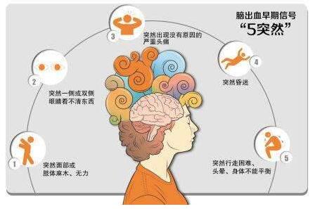 心腦血管病別等發(fā)作才篩查，經(jīng)顱多普勒TCD超聲檢測心腦血管